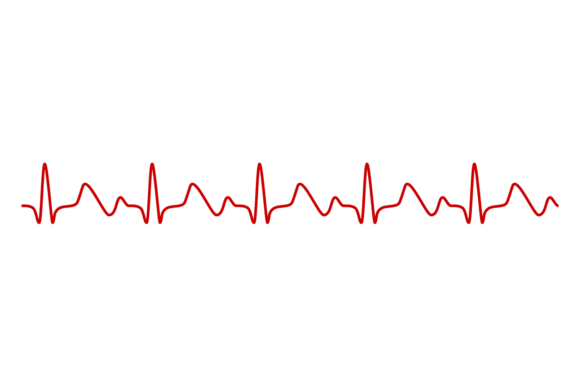 Cardio Pulse Graph. Medical Cardiogram H